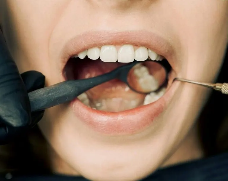 soñar con dientes rotos